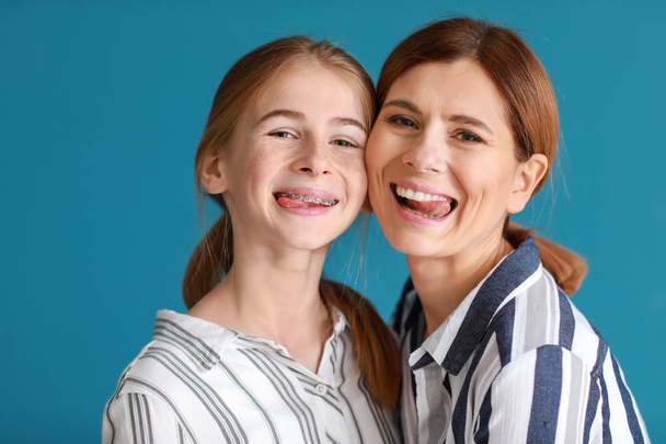 Portrait of funny mother and daughter on color background - Fotoğraf, Görsel
