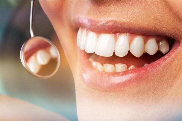 Woman teeth and a dentist mouth mirror - Zdjęcie, obraz