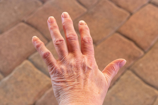 Dies sind die Hände einer alten Frau mit Fingerschmerzen - Foto, Bild