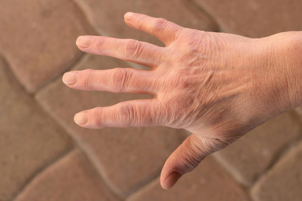 Ce sont les mains d'une vieille femme qui a mal aux doigts.
 - Photo, image