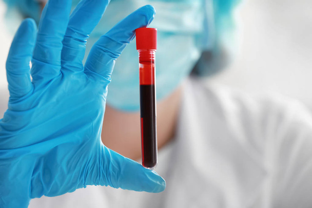 Mujer trabajando con muestra de sangre en laboratorio, primer plano
 - Foto, Imagen