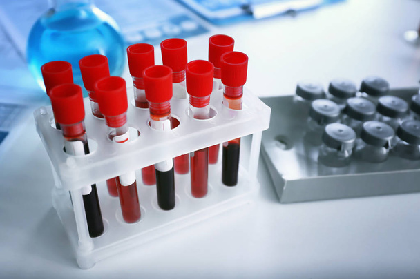 Tubes à essai avec échantillons de sang sur table en laboratoire
 - Photo, image