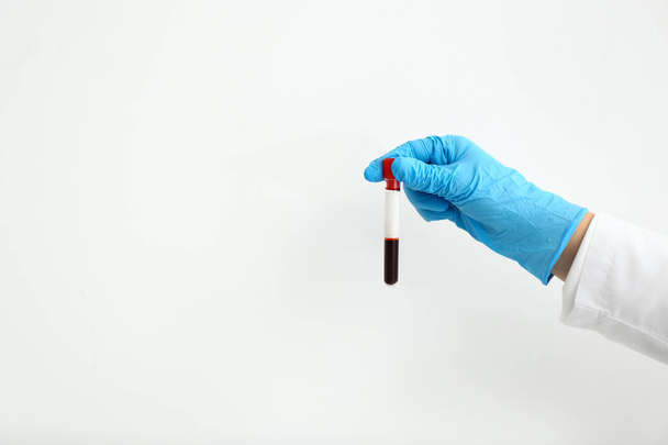 Mano del asistente de laboratorio que sostiene el tubo de ensayo con muestra de sangre sobre fondo blanco
 - Foto, Imagen