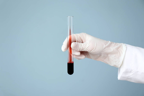 Hand of laboratory assistant holding test tube with blood sample on color background - Foto, imagen