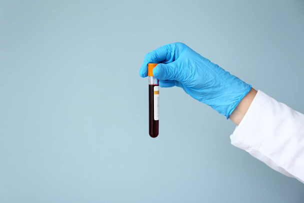 研究室アシスタント保持テスト管色の背景上の血液サンプルの手 - 写真・画像