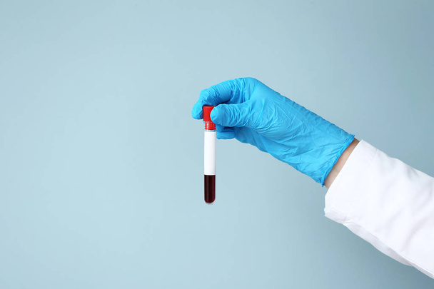 Hand of laboratory assistant holding test tube with blood sample on color background - Foto, Imagen