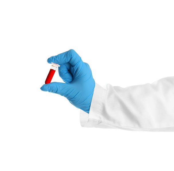 Laboratorion apulaisen käsi, jolla on koeputki, jossa on verinäyte valkoisella pohjalla
 - Valokuva, kuva