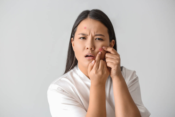 Portrait of young Asian woman with acne problem squishing pimples on white background - Foto, Imagem