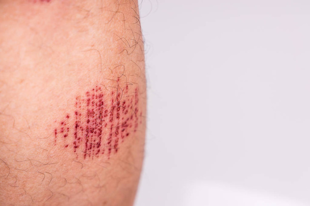 Людина з болючою травмованою ногою результат абразивного випадкового потрапляння в сток
 - Фото, зображення