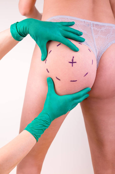 Surgeon drawing marks on female body before plastic operation, white background. Beautician touch and draw correction lines on womans buttocks. Liposuction concept - Photo, Image