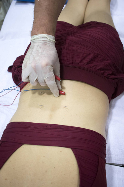 Physiotherapy clinic Intratissue Percutaneous Electrolysis EPI dry needling physiotherapist patient injury. - Foto, Imagem