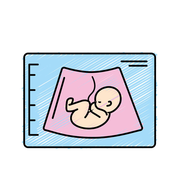 ultrasound of baby with umbilical cord vector illustration - Vector, Image