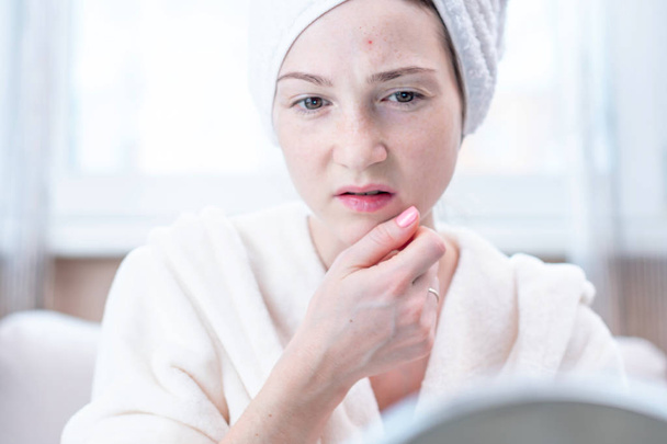 Mooie ongelukkige jonge vrouw met een handdoek op haar hoofd kijken acne op haar gezicht. Concept van hygiëne en verzorging voor de huid - Foto, afbeelding