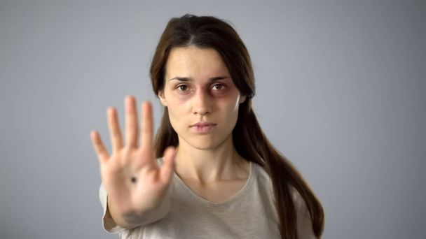 Bruised woman with black dot on hand, secret community for female victims - Valokuva, kuva