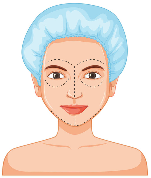 Dame visage peau botox illustration
 - Vecteur, image