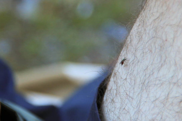 Mosquito full of blood bites on human leg - Photo, Image