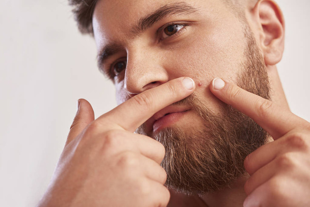 Close up foto di giovane uomo in cerca di acnes sul suo volto su sfondo grigio
 - Foto, immagini