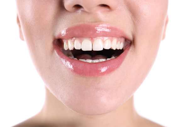 Młoda kobieta z zdrowe zęby uśmiechający się na białym tle, zbliżenie - Zdjęcie, obraz