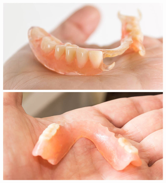 柔軟なナイロン義歯 - 写真・画像