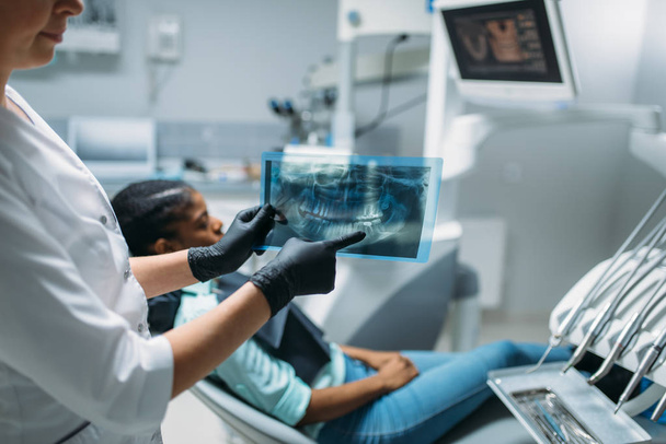 女性歯科医師は、x 線撮影、歯科医院、患者の背景に椅子に問題を示しています。キャビネットの歯科、口腔、歯のケアで女性 - 写真・画像