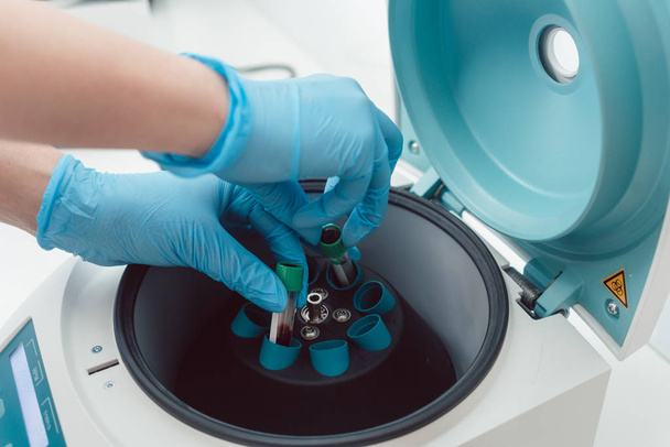 Arts of lab technicus bloedmonsters aanbrengend centrifuge - Foto, afbeelding