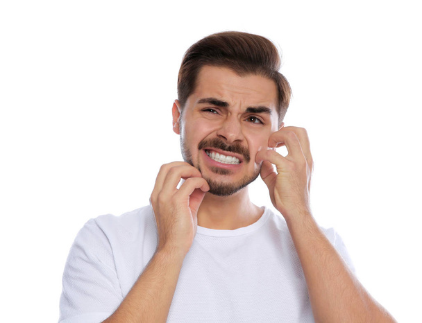 Young man scratching face on white background. Annoying itch - Foto, afbeelding