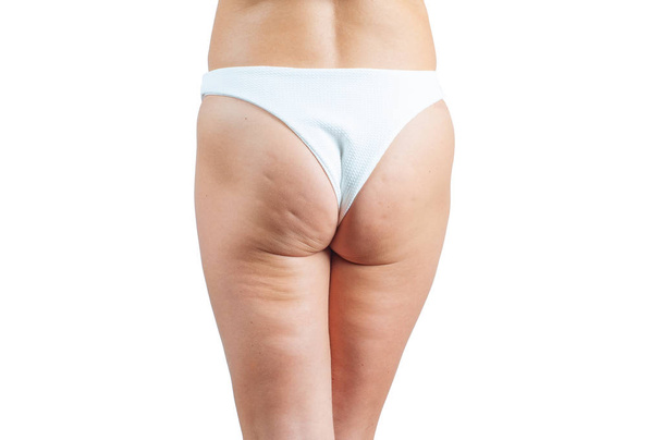 Female buttocks with cellulite. Cellulite skin at woman buttocks - Fotoğraf, Görsel