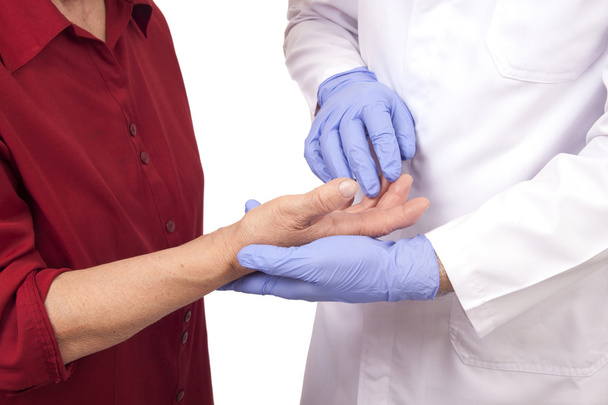 Együtt élni a reumával - Rheumatoid arthritisben szenvedő kezek