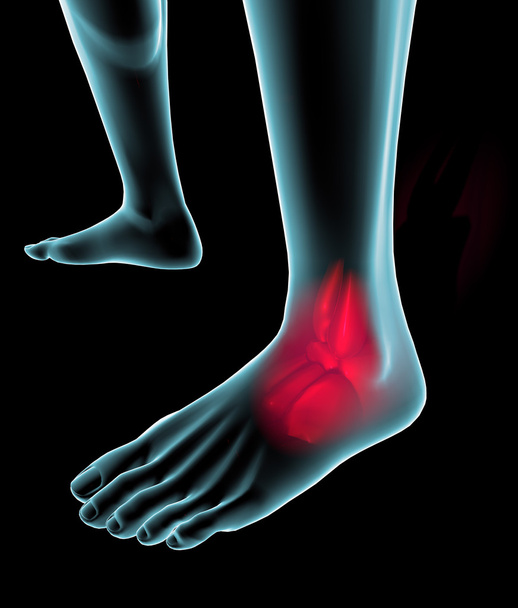 Fuß mit Schmerzen auf Röntgenbild gesehen - Foto, Bild