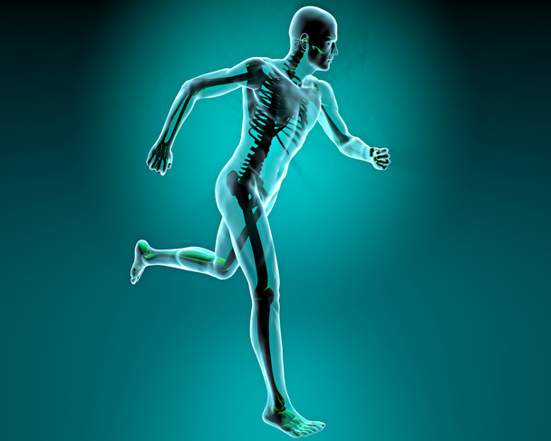Sportler rast auf Röntgenbild - Foto, Bild