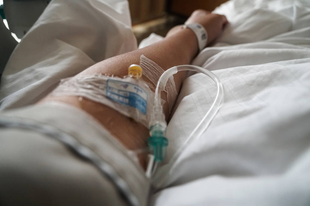 brazo del paciente con tubo intravenoso en el hospital
 - Foto, imagen