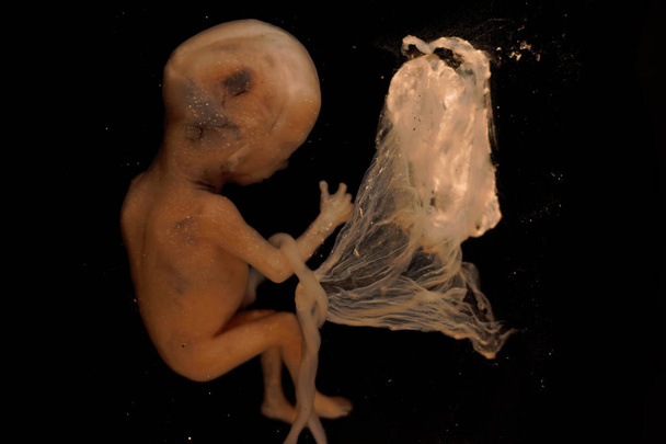 Человеческий плод на третьем месяце беременности. Сохраняется в формальдегиде
. - Фото, изображение