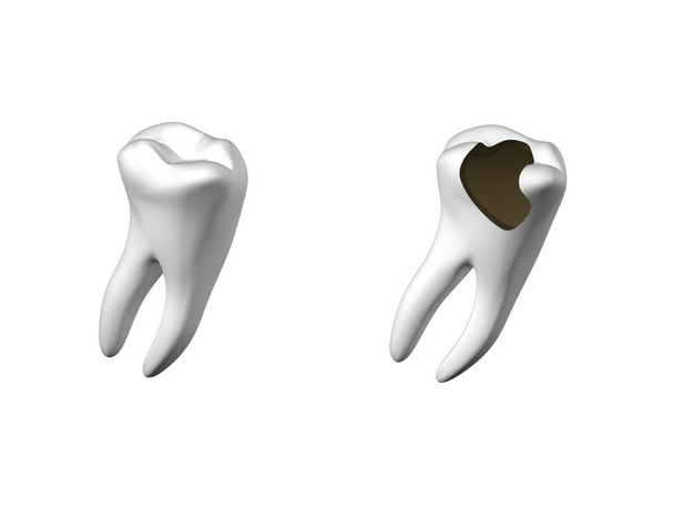 diente humano
 - Foto, Imagen
