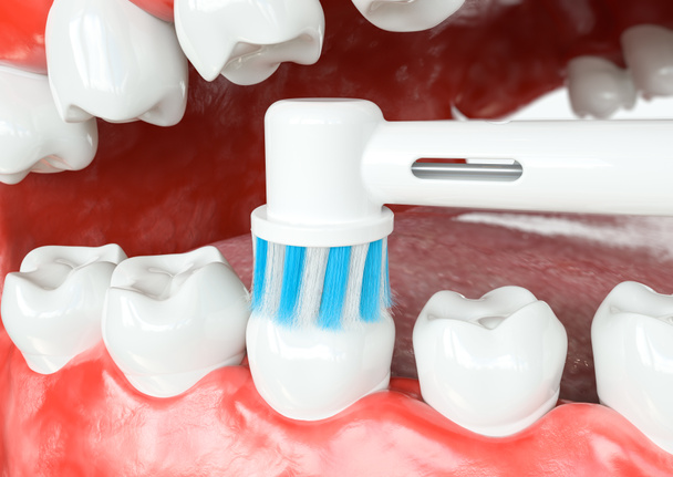 歯の咬合面の清掃 - 3d レンダリング - 写真・画像