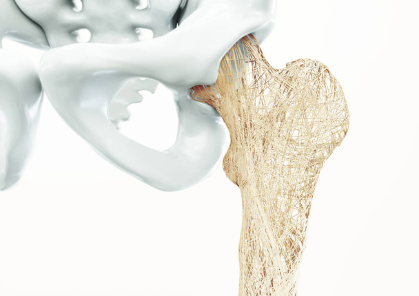 Οστά άνω άκρου οστεοπόρωση - ανθρώπινο σώμα - Φωτογραφία, εικόνα