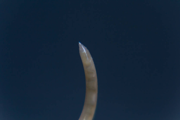 Toxocara cati roundworm tail, close-up view - Photo, Image