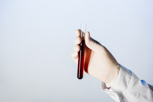 Vista parcial del médico en guante médico sosteniendo tubo de ensayo con sangre
  - Foto, Imagen