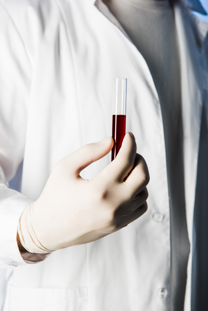 Vista recortada del médico en guante médico sosteniendo tubo de prueba con sangre
  - Foto, Imagen
