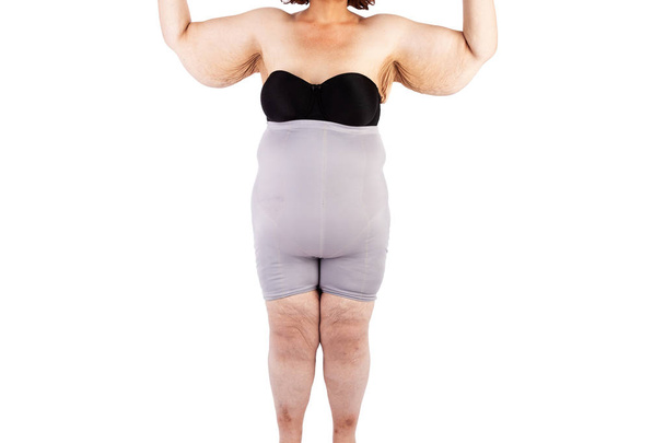 中年のたるみ余分な腕の皮膚極端な減量を持つ女性。ポスターとミームの前にオーストラリアで brachioplasty、脂肪層切除、腹部およびミイラの変身のためのインスピレーション. - 写真・画像
