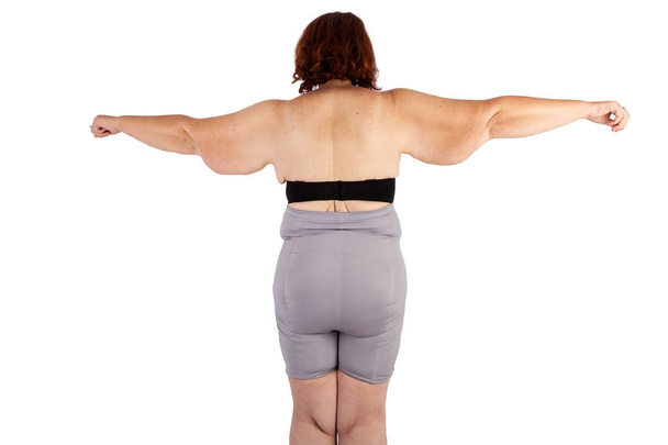 中年のたるみ余分な腕の皮膚極端な減量を持つ女性。ポスターとミームの前にオーストラリアで brachioplasty、脂肪層切除、腹部およびミイラの変身のためのインスピレーション. - 写真・画像