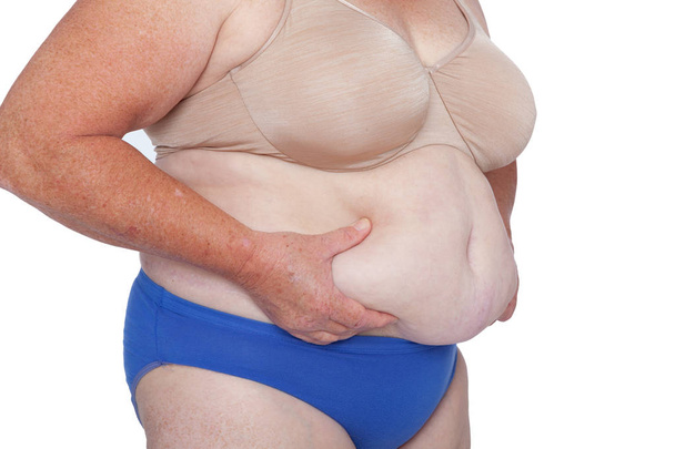 Brachioplasty、脂肪層切除、腹部とミイラの変身後の体重増加と更年期の女性。45 度右利用両手は過剰腹部体重、コピー スペースです。変身インスピレーション. - 写真・画像