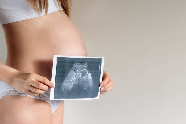A pregnant woman of Caucasian appearance stands with a photograph of an ultrasound scanner on a beige background, close-up - Fotografie, Obrázek