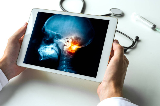 デジタル タブレットの上に頭蓋骨の首の痛みの x 線写真を見ている医師。Meningis、頭痛および放射線のコンセプト - 写真・画像