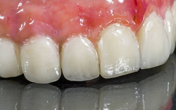 Mandíbula artificial superior con dientes sobre fondo negro
 - Foto, Imagen