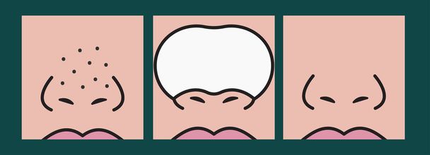 Cleansing of blackheads on nose cosmetic strips, dots on nose. Patches for cleaning skin. Home skin care. Vector illustration - Vector, Image