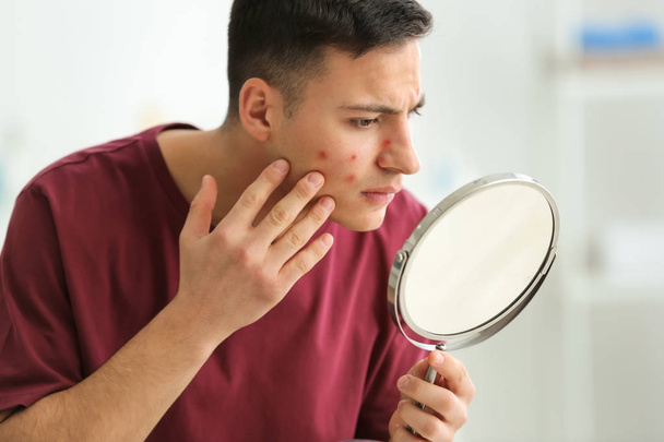 Porträt eines jungen Mannes mit Akne-Problem, der zu Hause in den Spiegel schaut - Foto, Bild