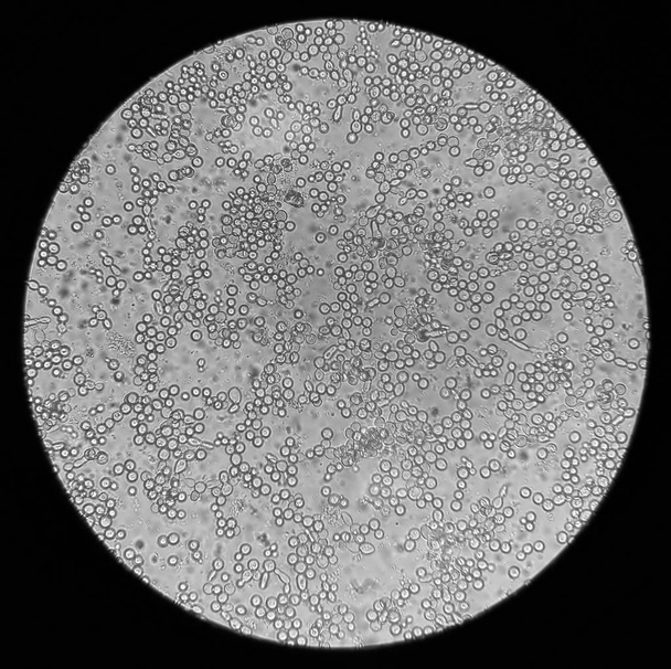visão microscópica dos fungos candida albicans
 - Foto, Imagem
