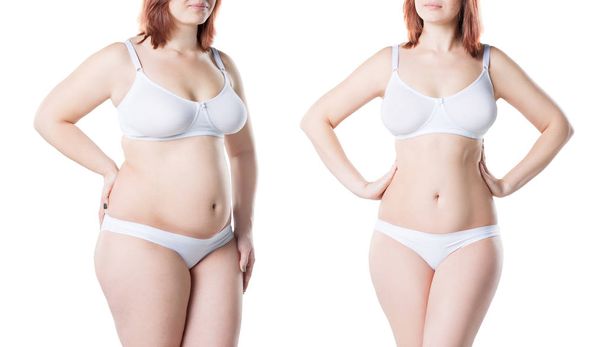 Woman's body before and after weight loss isolated on white background, plastic surgery concept - Foto, afbeelding