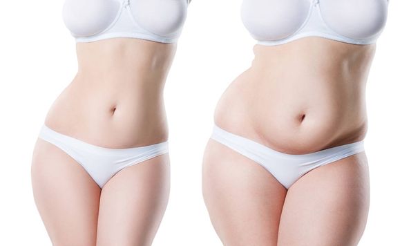 Woman's body before and after weight loss isolated on white background, plastic surgery concept - Foto, immagini