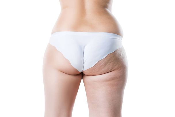 Overweight woman with fat cellulite legs and buttocks, before after concept, obesity female body isolated on white background, rear view - Photo, Image